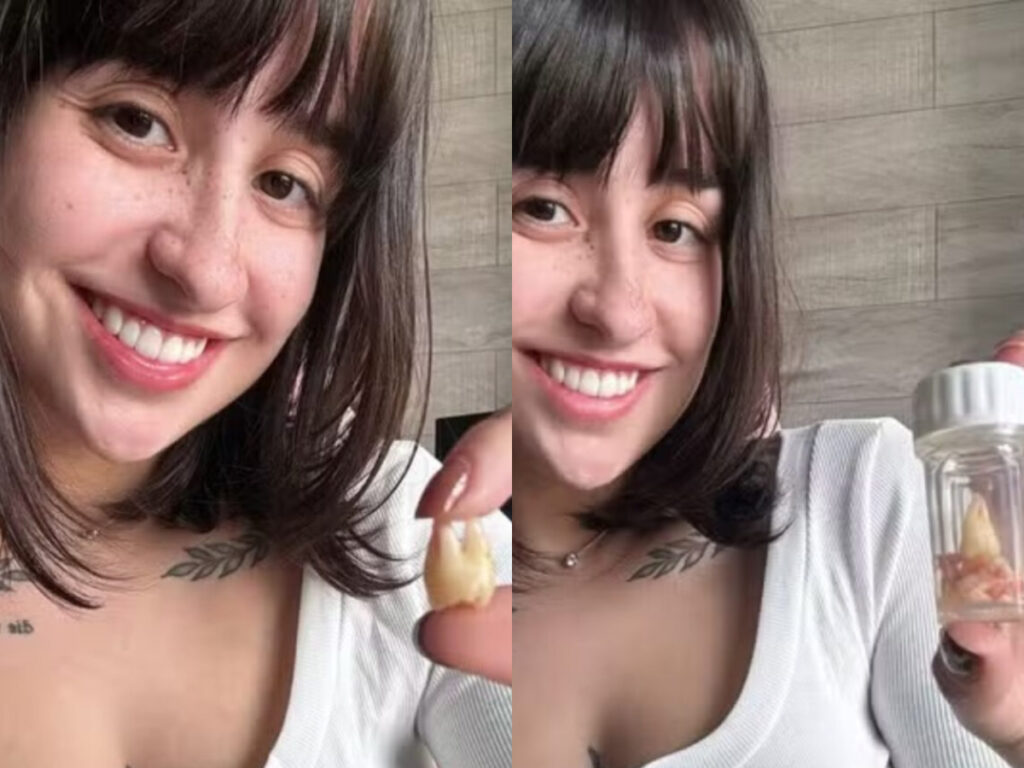 Beiçola da Privacy anuncia venda dos dentes por R$ 40 mil e gera polêmica: “Crime”