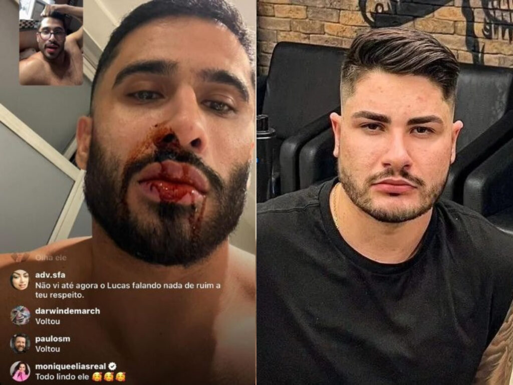 Ex de Lucas Souza o acusa de agressão e expõe os machucados. Veja fotos