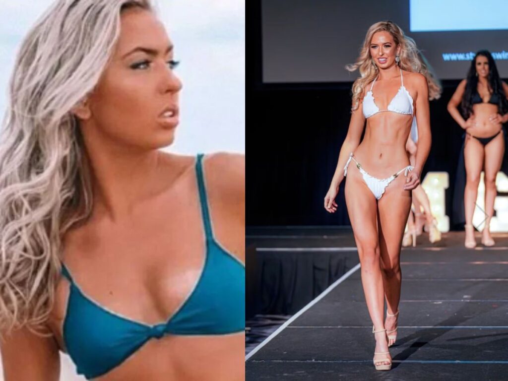 Modelo revela que nasceu com duas vaginas e sem ânus