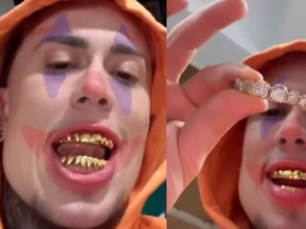 Conheça os famosos que aderiram ao ‘grillz’