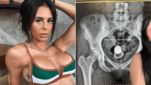 A atriz australiana Alicia Davis viveu uma situação inusitada