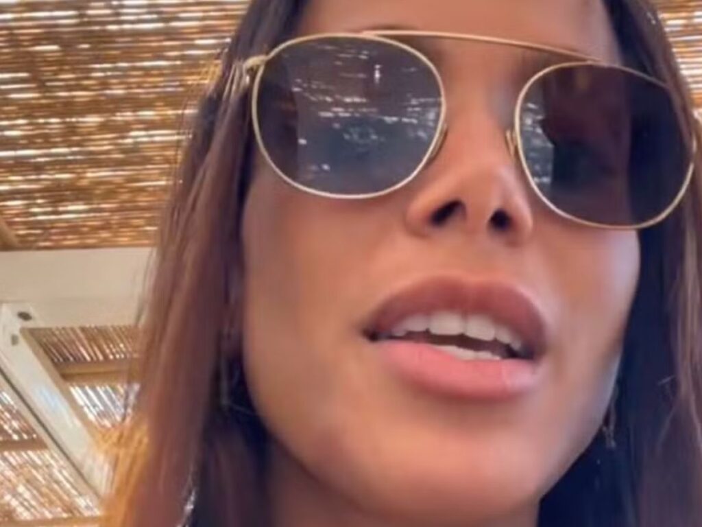 Anitta mostra queimaduras por águas-vivas em Ibiza: “Me queimei inteira”