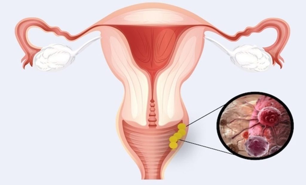 Vagina(1)