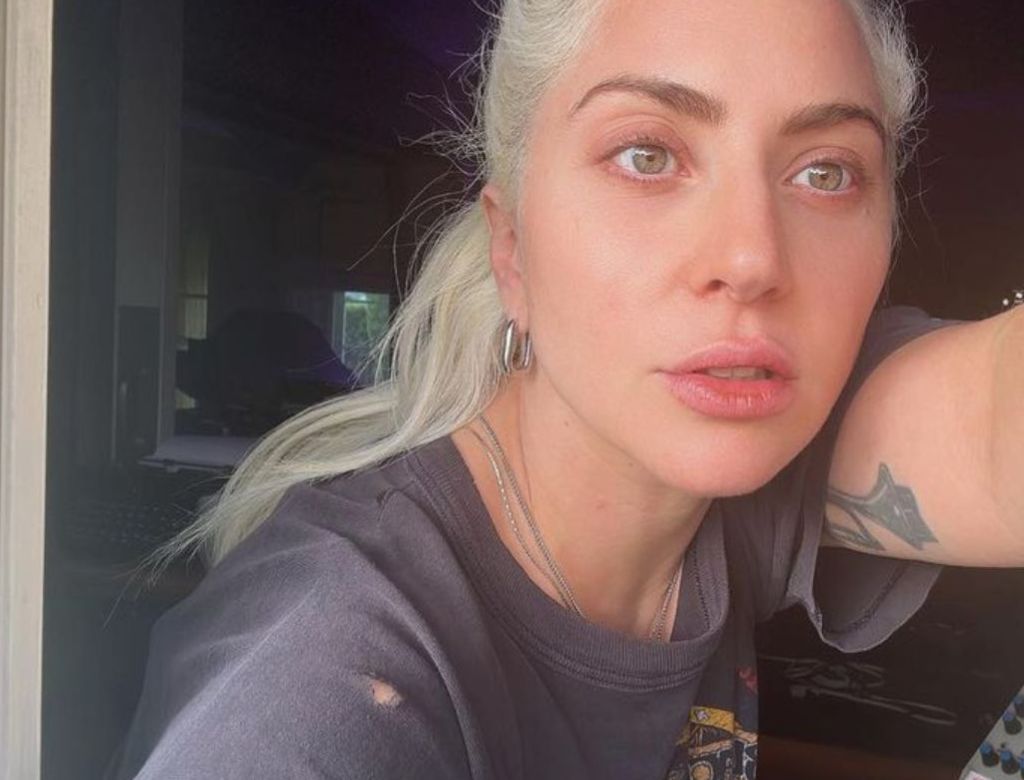 Lady Gaga (foto Reprodução Redes Sociais) (2)