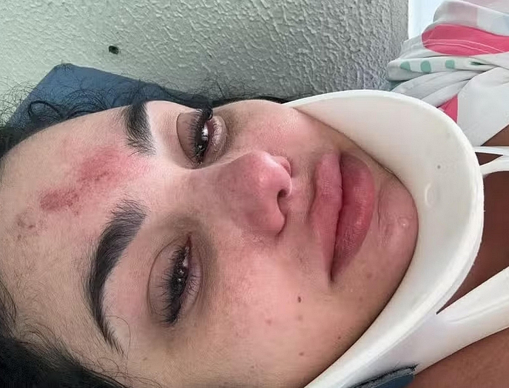 Acidente (foto Reprodução Redes Sociais) 7