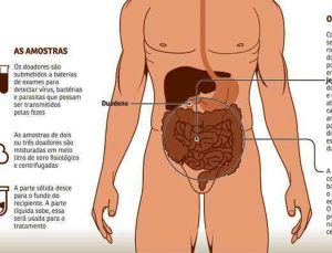 Transplante(1)