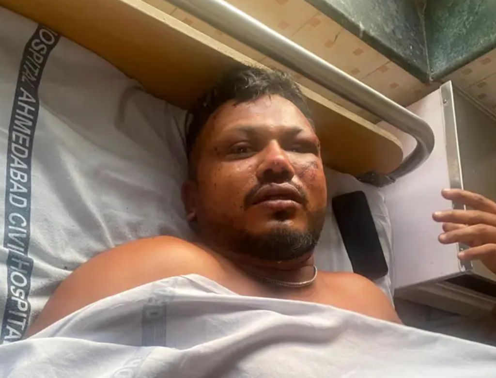Único Sobrevivente De Queda Da Air India Desabafa Após Perder O Irmão (foto Reprodução Redes Sociais)