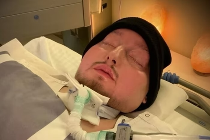Saiba quem era o “príncipe adormecido”, que morreu após 20 anos em coma