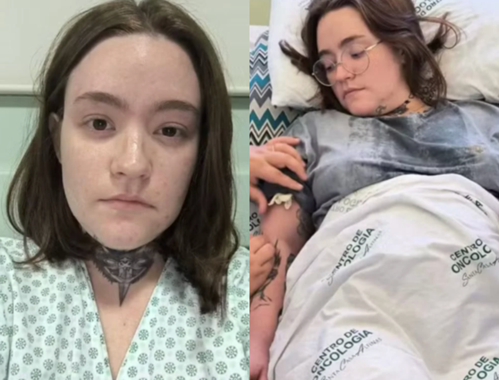 Mulher com a pior do mundo é induzida ao coma e ‘reinicia’ cérebro; entenda