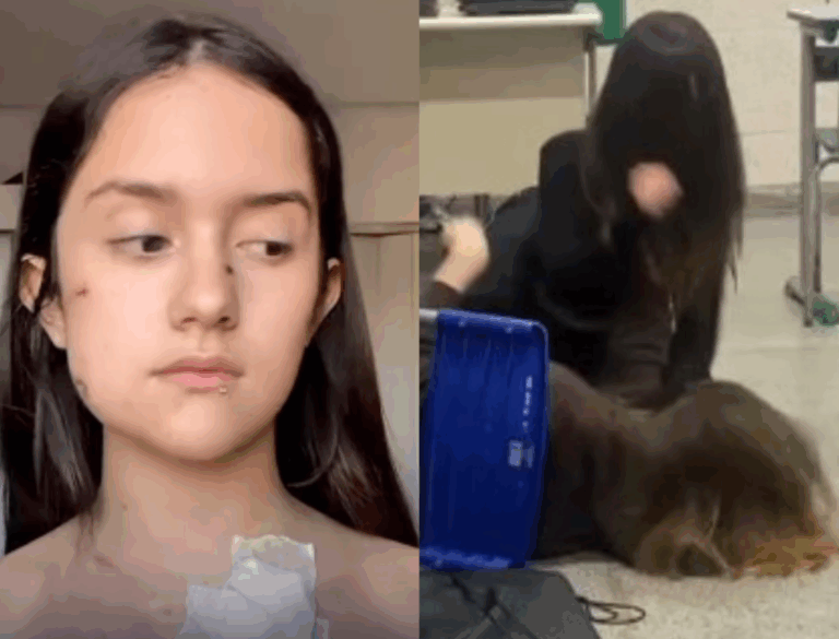 VEJA VÍDEO: Menina que levou tesourada na escola revela motivo da briga ...