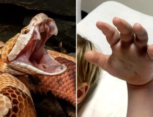 Menino de 4 anos é atacado por cobra venenosa enquanto brincava na creche; veja VÍDEO