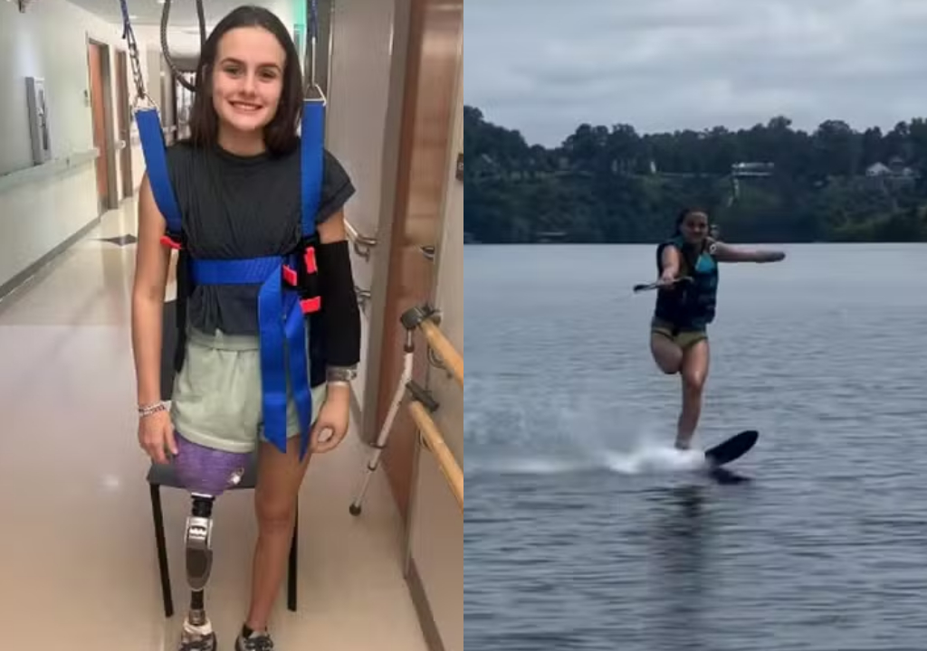 Jovem volta à praia onde sofreu ataque de tubarão (Foto: Reprodução)
