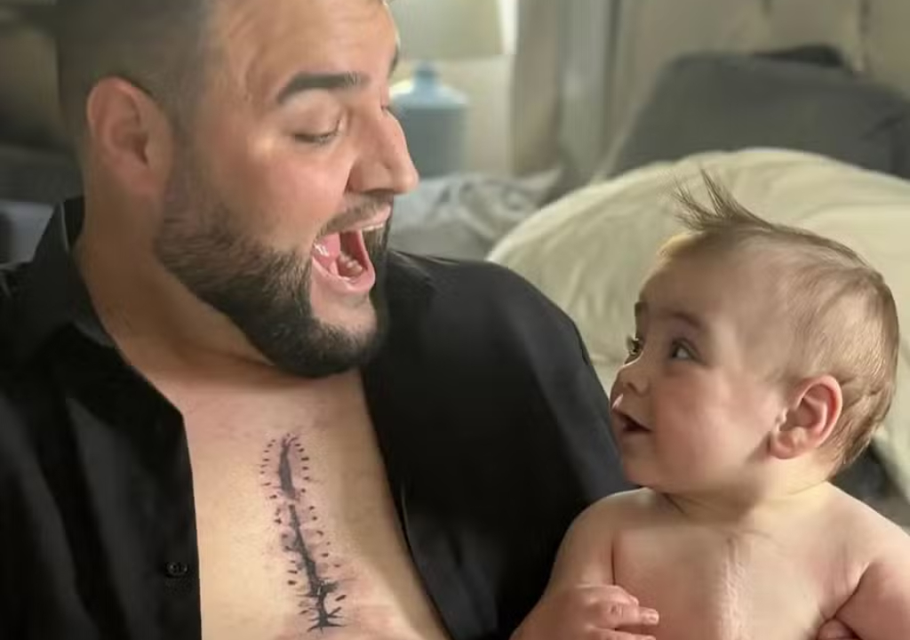 Pai faz tatuagem de cicatriz (Foto: Reprodução)