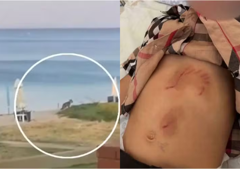 Menina é atacada por lobo (Foto: Reprodução)