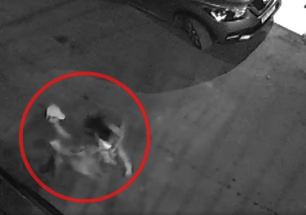 Criança é atacada por pitbull (Foto: Reprodução)