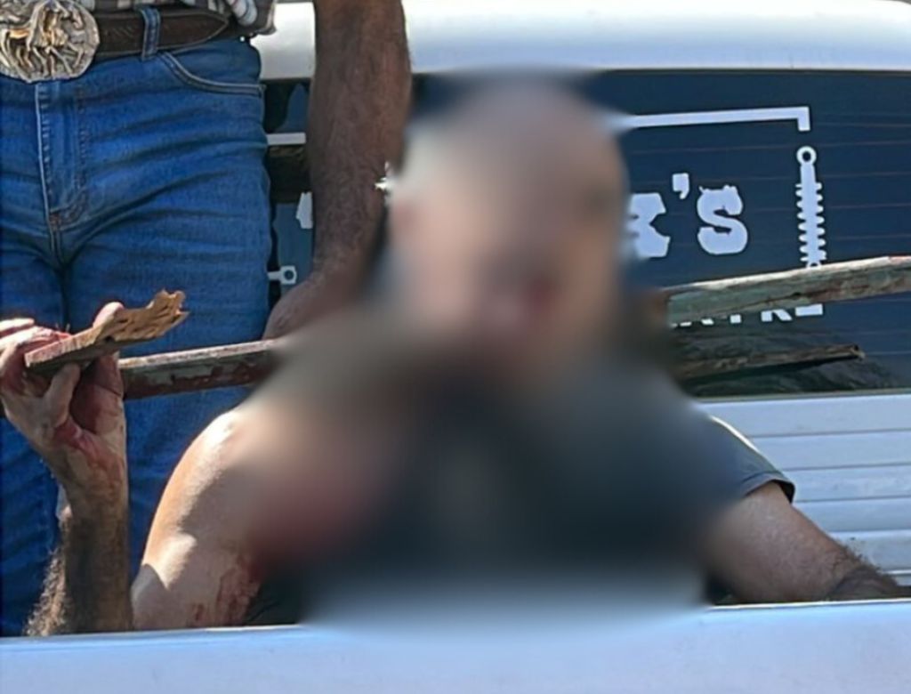 Homem com madeira atravessada no pescoço (Foto: Reprodução Redes Sociais)