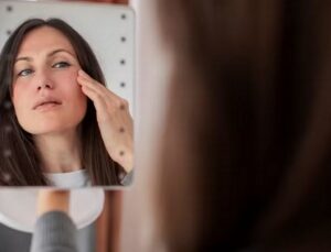 Saiba como tratar rugas, olheiras e flacidez ao redor dos olhos