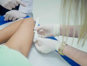 Ministério da Saúde recebe primeiras unidades de implante contraceptivo para o SUS; saiba como funciona