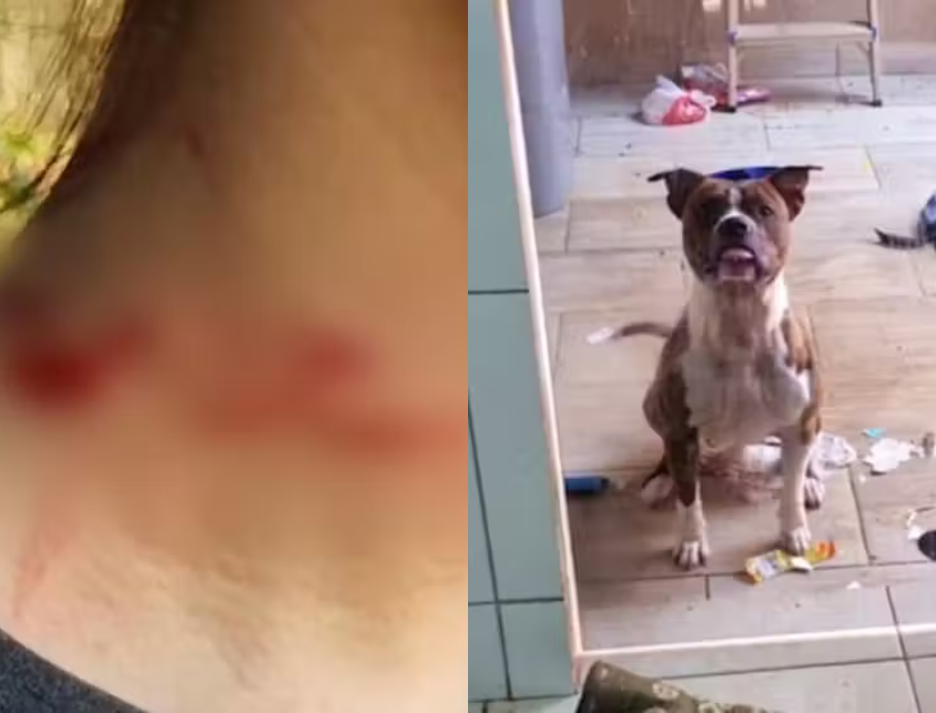 Pitbull salva menina (Foto: Reprodução)