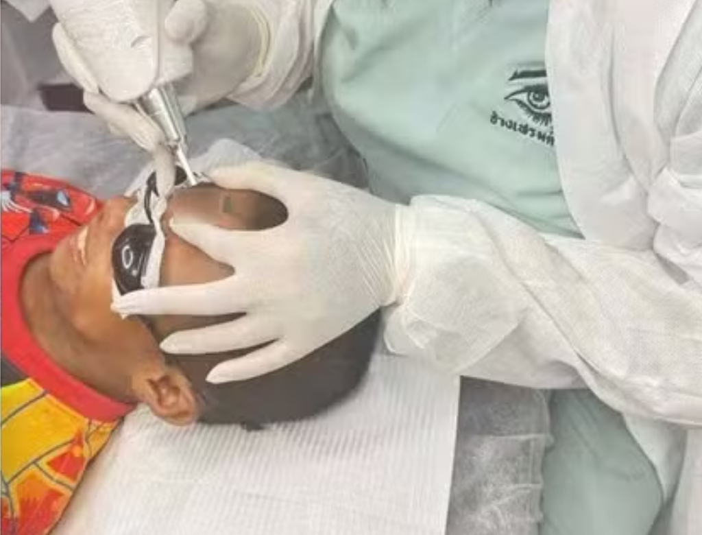 Menino removendo tatuagem (Foto: Reprodução)