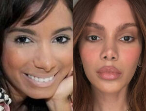 Antes e depois de Anitta (Foto: Reprodução)