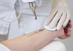 Tatuagem (Foto: Reprodução)