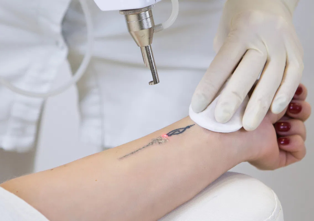 Tatuagem (Foto: Reprodução)