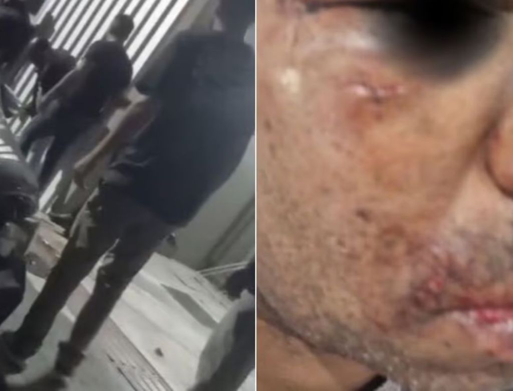 Ambulante é agredido por homem que se identificou como policial; VEJA VÍDEO!