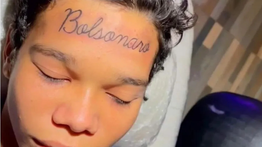 Jovem remove tatuagem de Bolsonaro na testa e acaba no prejuízo; Veja vídeo!