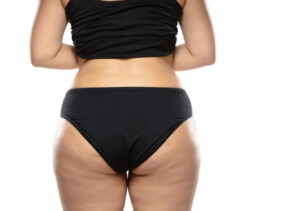 Bunda (Foto: Reprodução)