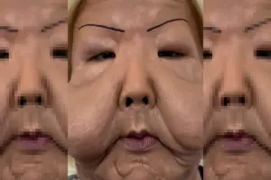 Juju do Pix reaparece e mostra evolução após cirurgia delicada no rosto; veja como ela está