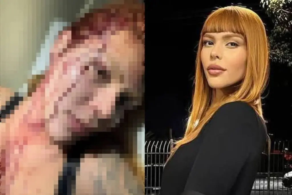 Modelo trans é atacada por 4 na zona leste de SP; Veja vídeo