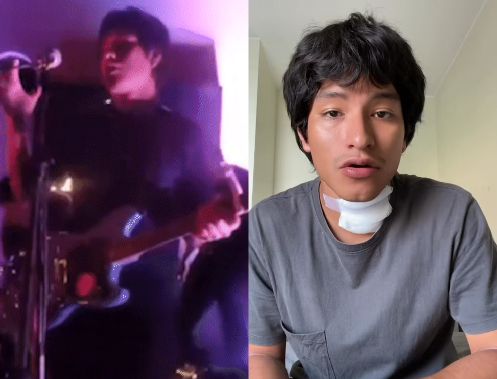 Cantor desmaia após levar choque do próprio microfone durante show no Peru; veja vídeo