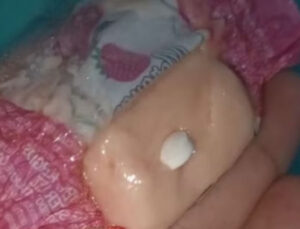 Criança é internada após comer bala distribuída por pessoas fantasiadas de Papai Noel em MG