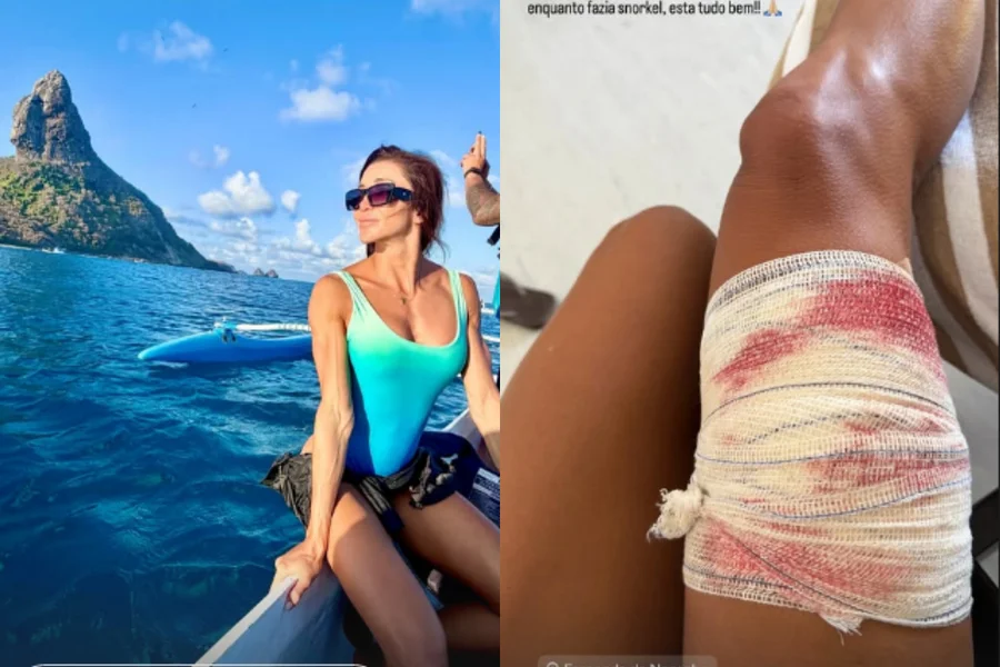 Veja o momento exato que mulher ter perna mordida por tubarão em Noronha
