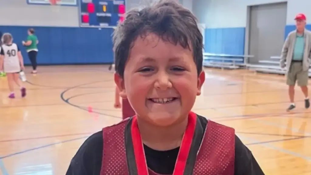 Menino de 9 anos fica com o rosto deformado após participar de desafio no Tiktok; veja antes e depois