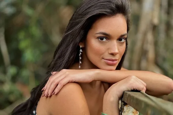Ex-BBB Alane Dias sofre atropelamento por moto no RJ
