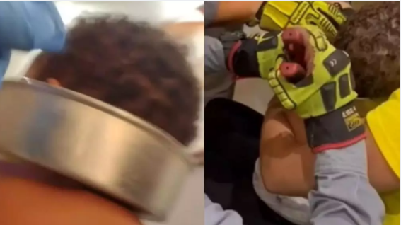 Bebê fica com cabeça presa em forma de bolo e mobiliza resgate em SP; veja