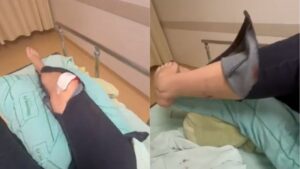 Deputada bolsonarista é atacada por cachorro e fratura a perna; veja vídeo