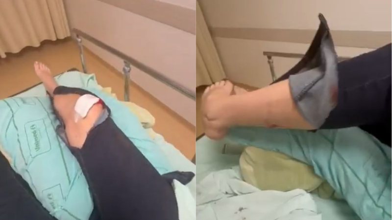 Deputada bolsonarista é atacada por cachorro e fratura a perna; veja vídeo