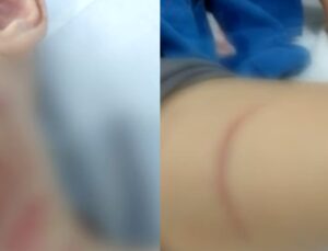 Mãe luta contra pitbull para salvar filho de ataque de cão; VEJA VÍDEO