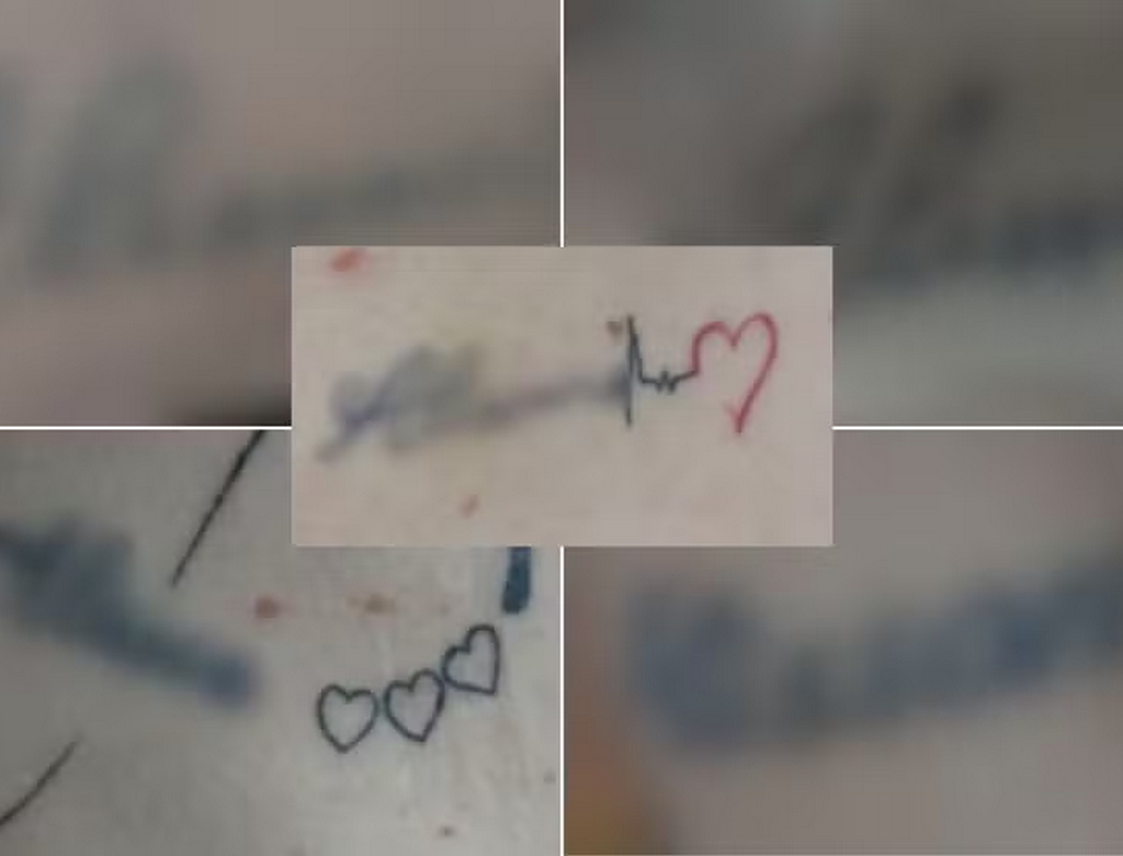 Vítima (Foto Reprodução Redes Sociais)