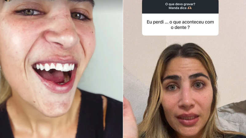 Filha de Leonardo conta como quebrou o dente; descubra