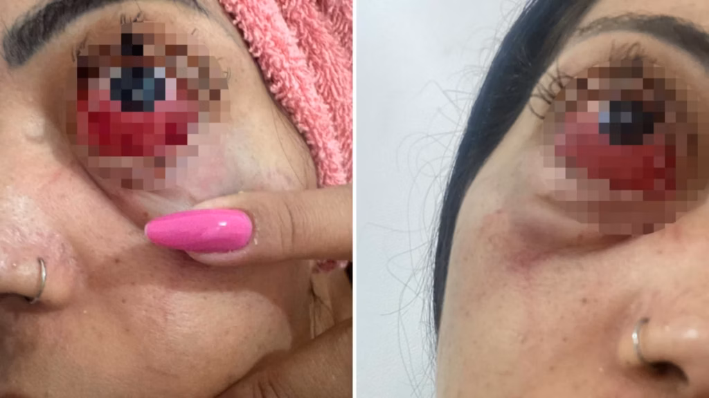Após fim de namoro, mulher relata espancamento e ameaça de morte em BH; veja!