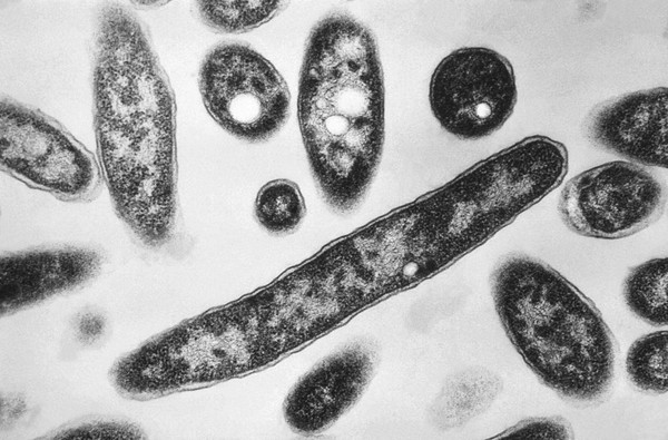 O que é a doença dos legionários, infecção que já matou duas pessoas e infectou mais de 70 em surto
