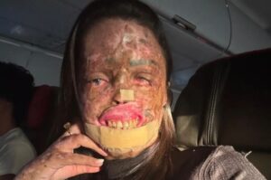 Influenciadora Karine Felipe morre aos 37 anos após enfrentar doença genética rara