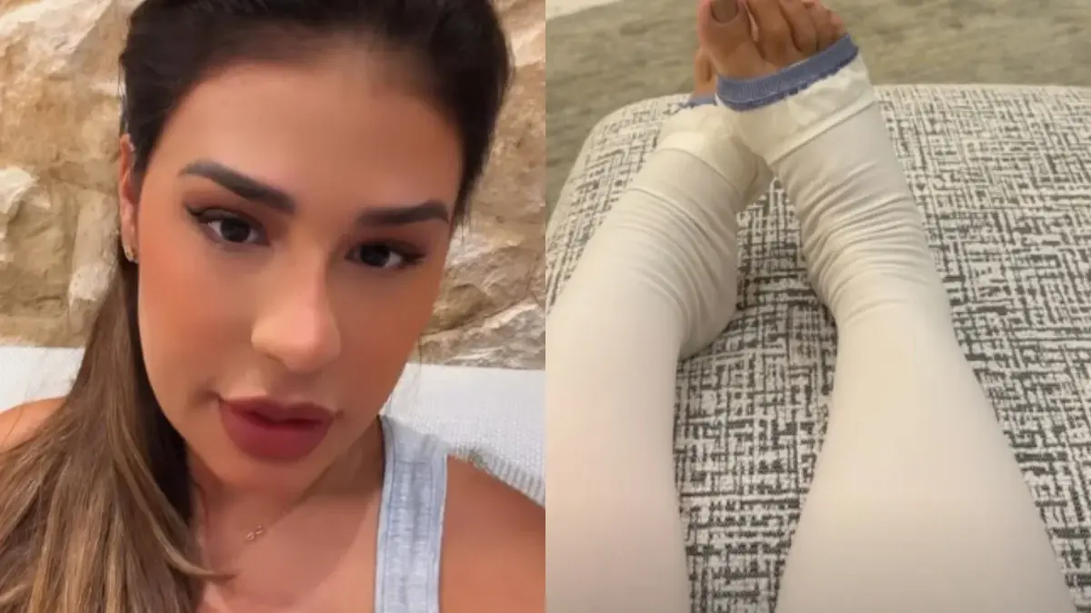 Simone Mendes revela cirurgia para retirar excesso de pele das coxas após emagrecimento