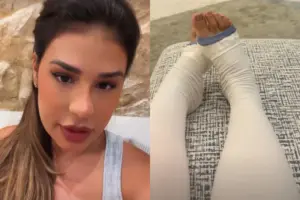 Simone Mendes revela cirurgia para retirar excesso de pele das coxas após emagrecimento