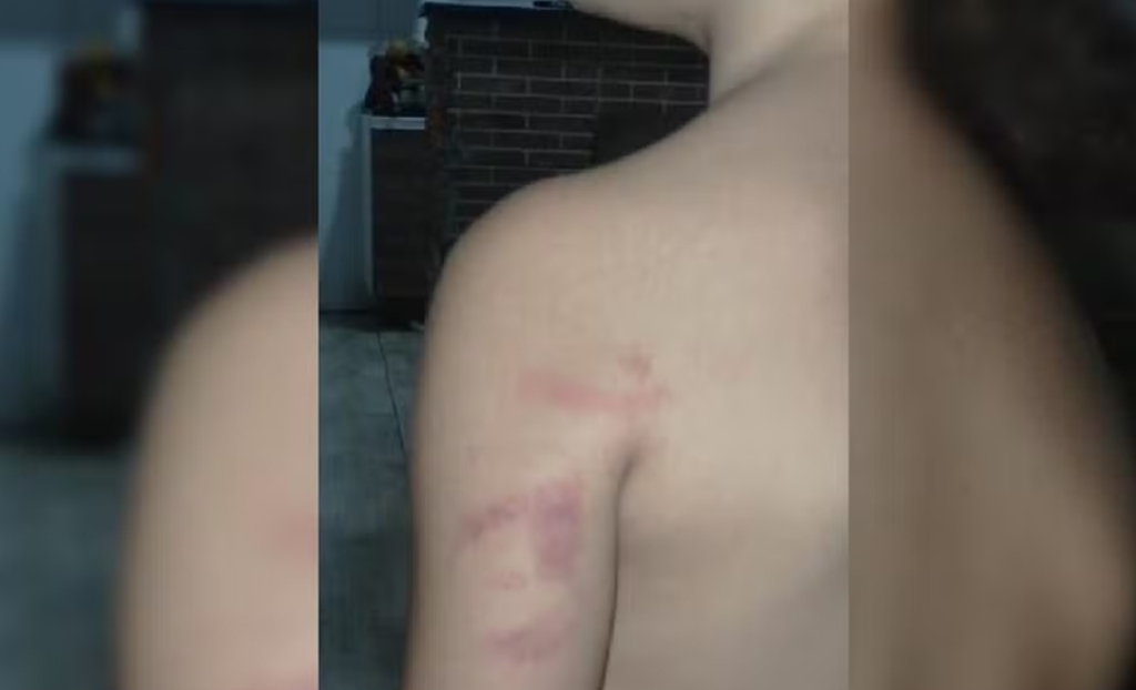 (Foto Reprodução Sandra, Mãe Da Menina)