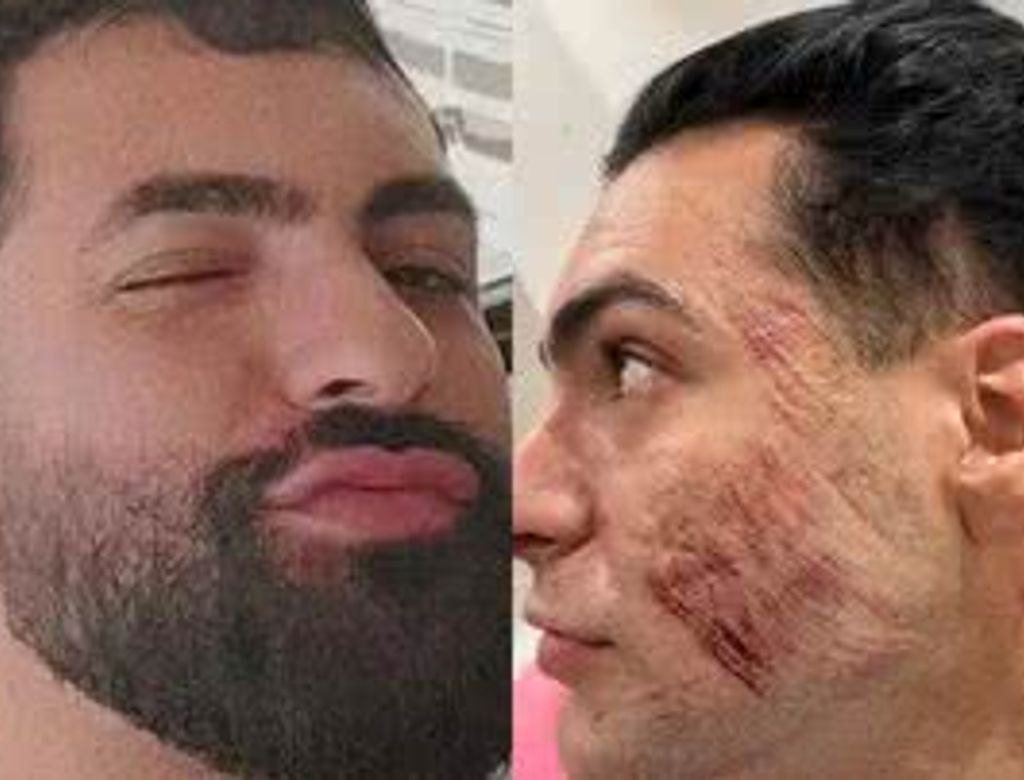 Empresario Que Morreu Por Peeling De Fenol Widemd(1)